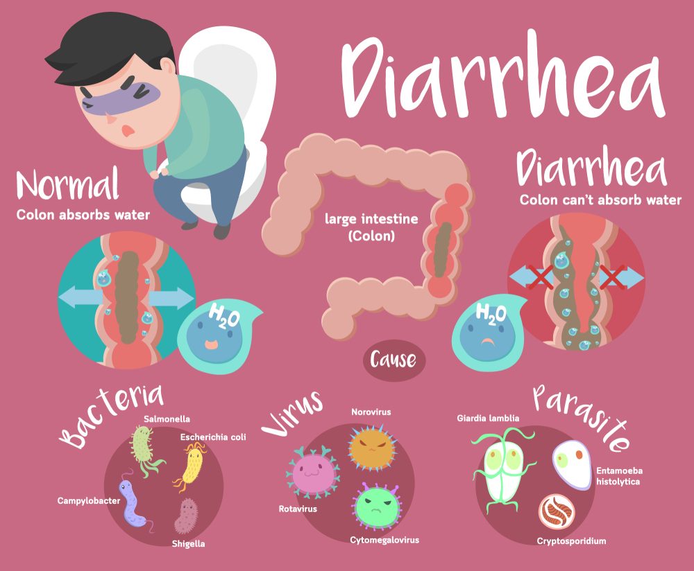 Diarrhea symptoms