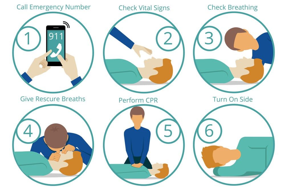 External Cardiac Massage First Aid For Cardiac Arrest Health