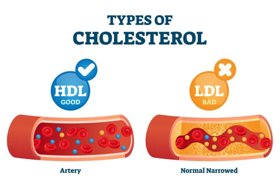 cholesterol