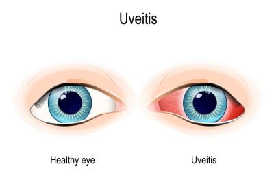 What is the Uvea of the Eye?