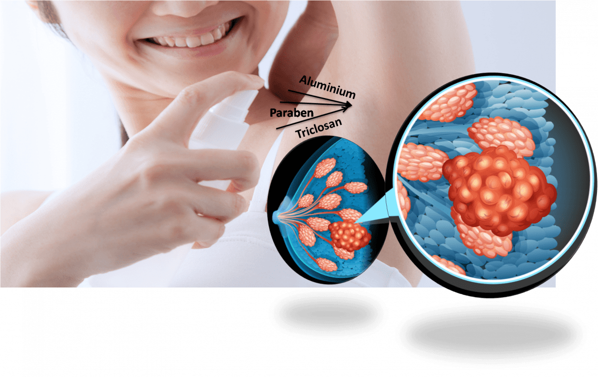 How Deodorants Cause Breast Cancer? » FreakToFit
