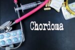 chordoma tailbone