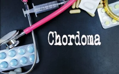 chordoma tailbone