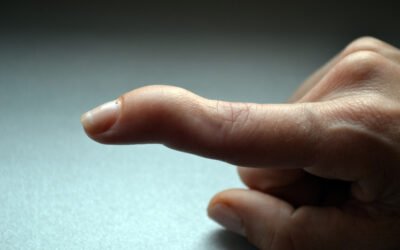 Amazing 6 Mallet Finger Exercises For Quick Recovery