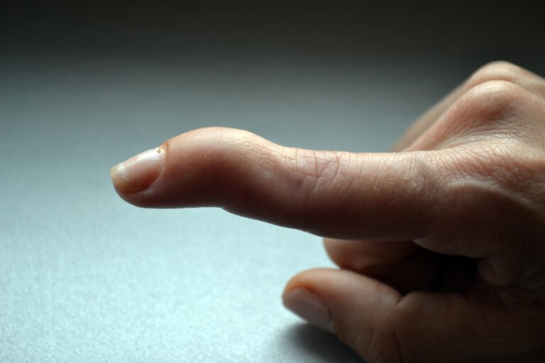 Amazing 6 Mallet Finger Exercises For Quick Recovery » Fitness