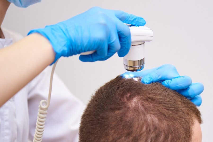 Amazing Gfc Therapy For Hair Loss : Is It Really Safe Than Prp?