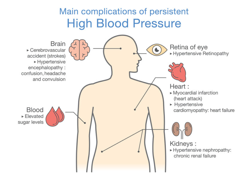 High-Blood-Pressure