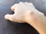 ganglion cyst wrist exercises