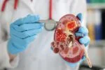 Nutrição Essencial para Insuficiência Renal: Um Guia Alimentar