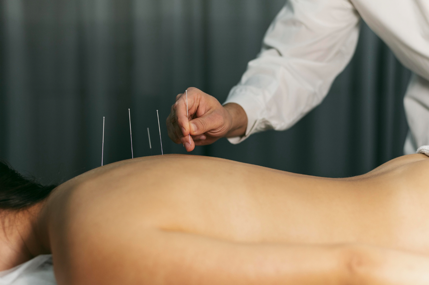 Acupuncture Points