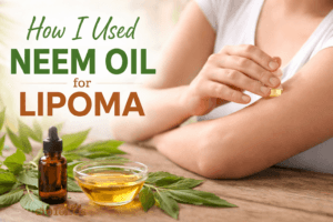 Minyak nimba untuk lipoma